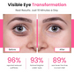Eye Revitalize – Red Light Therapy for Dark Circles & Eye Bags